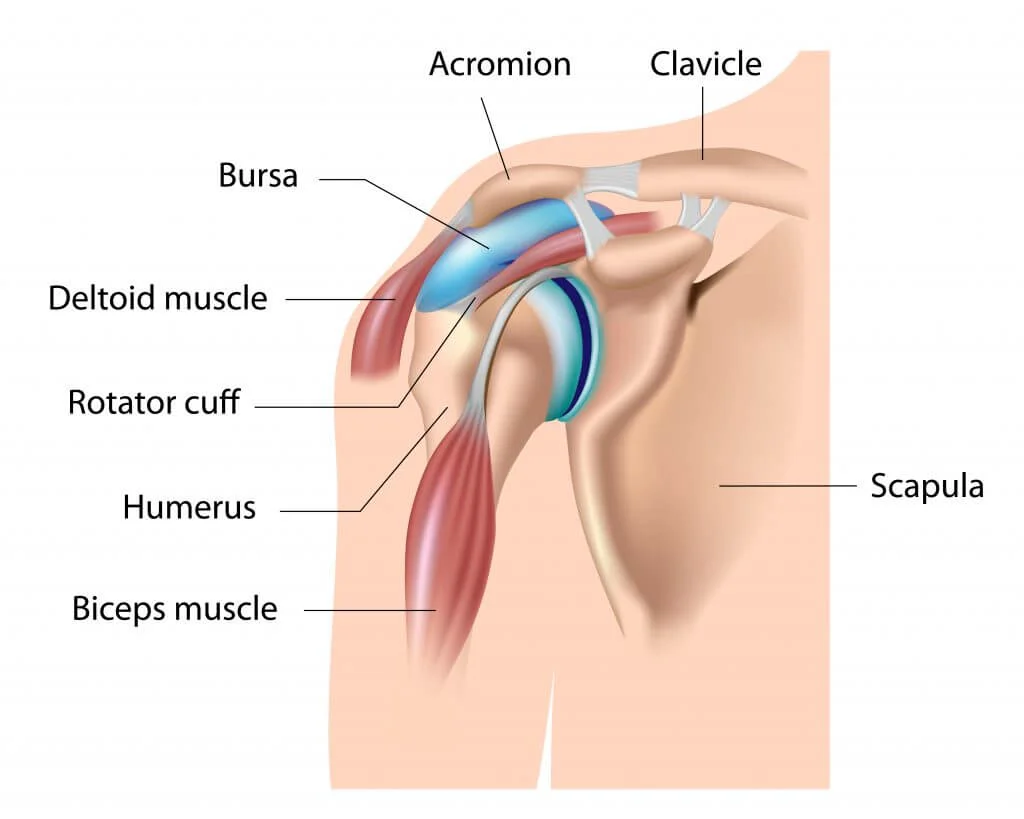 Shoulder Bursitis: Easing Pain and Restoring Mobility