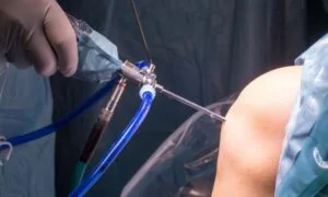 Surgical Interventions and When They're Needed