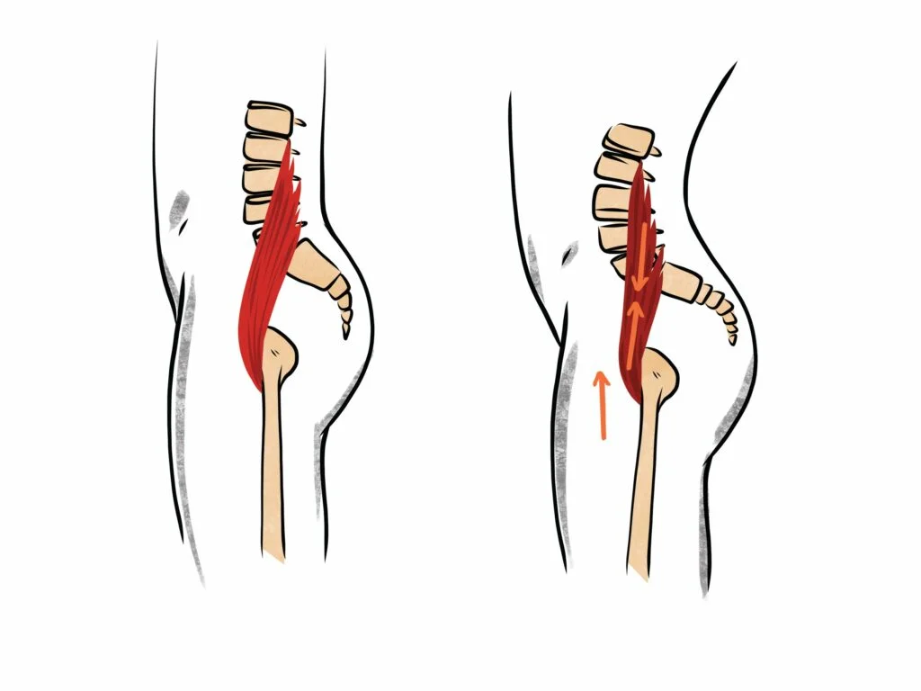 Tilted Pelvis Pain: Causes and Treatment Methods