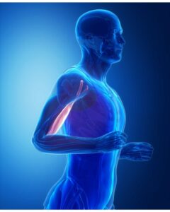 Understanding Distal Bicep Tendonitis