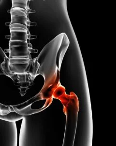 Understanding Hip Nerve Anatomy