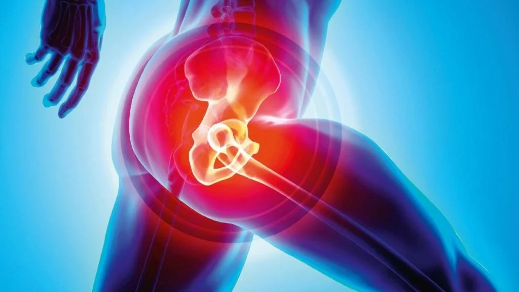 Understanding Hip Replacement Pain and Managing It Effectively