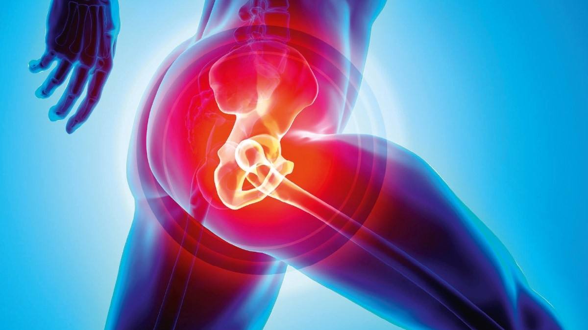 Understanding Hip Replacement Pain and Managing It Effectively
