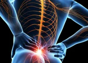 Understanding Piriformis Syndrome
