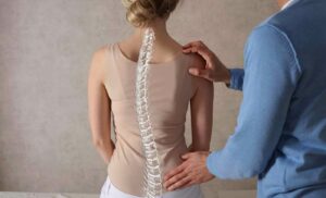 Understanding Scoliosis
