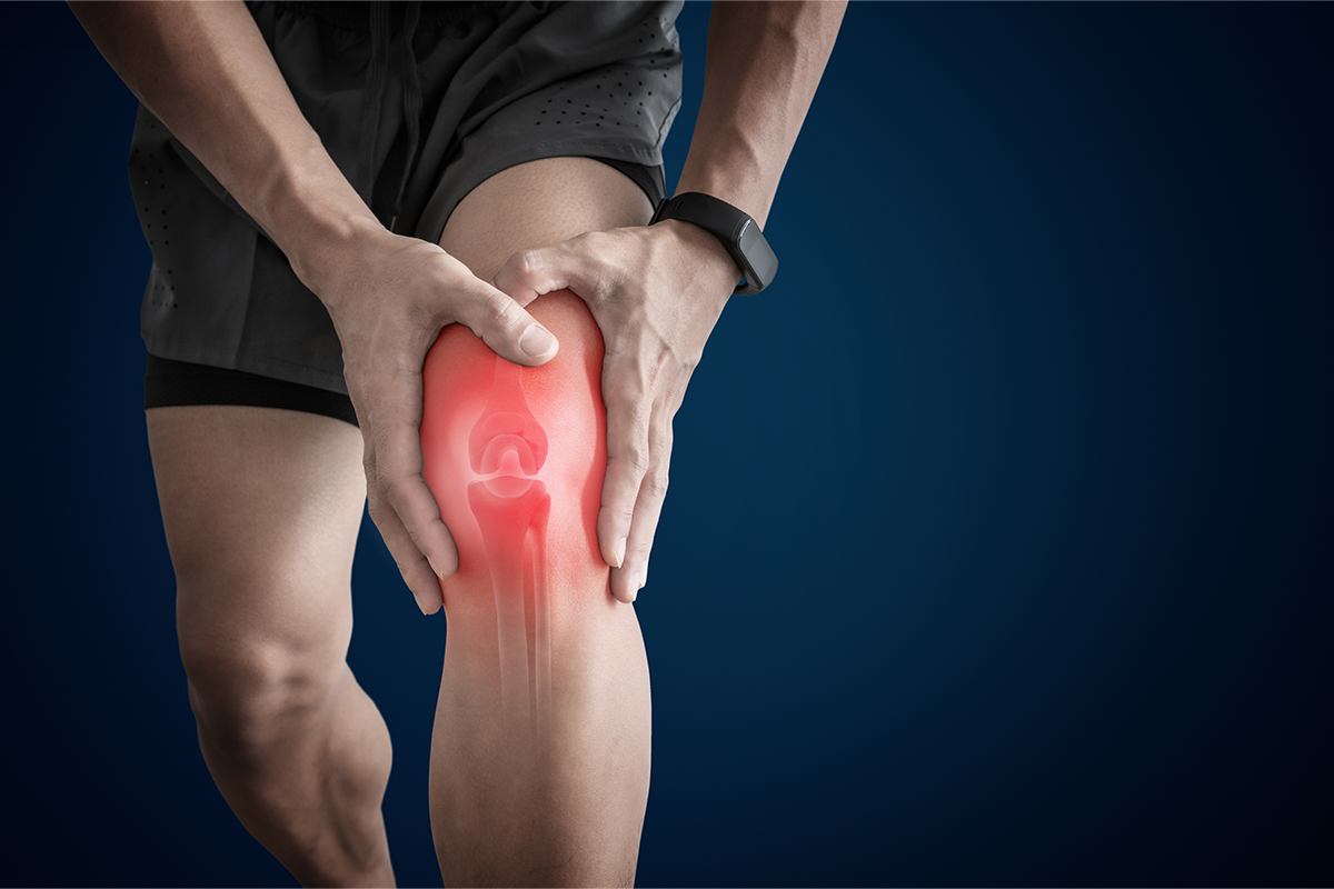 Understanding Knee Arthritis: Causes, Symptoms, and Management