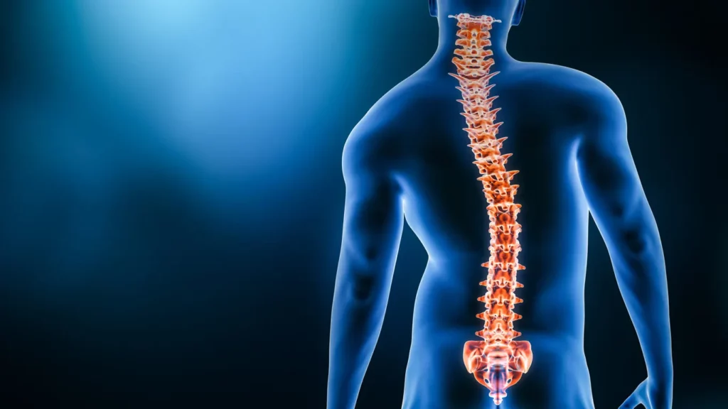 back scoliosis