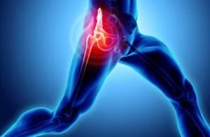 Can Hip Flexors Cause Back Pain?