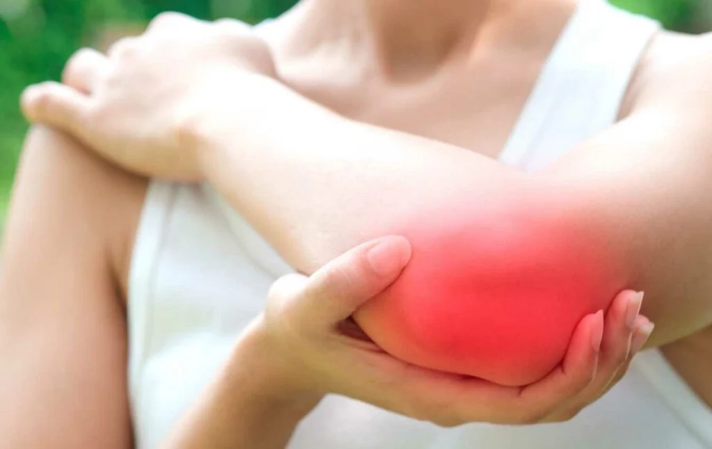 elbow bursitis