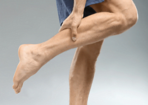Common Causes of Leg Pain