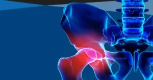 What Causes Hip Capsule Pain?