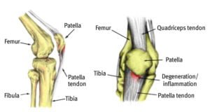 Incorporating Physical Therapy into Your Routine 