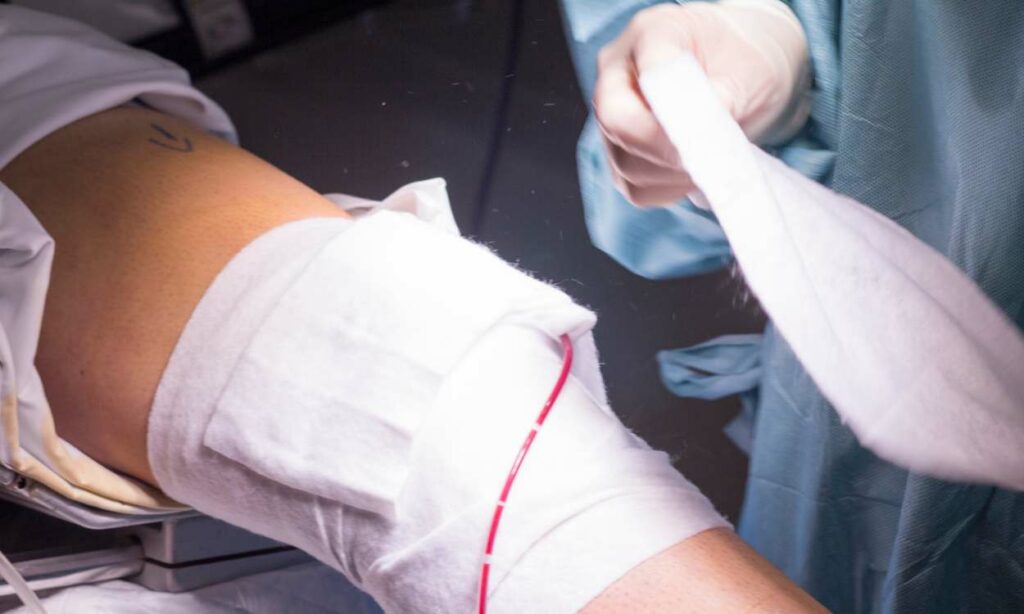 kneecap pain treatment