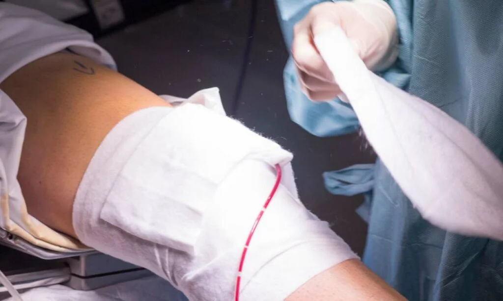 kneecap pain treatment