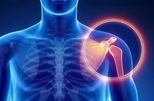 Diagnosing Shoulder Pain When Breathing