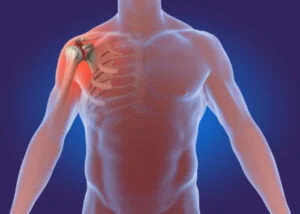 Remedies at Home: Taking Initial Steps