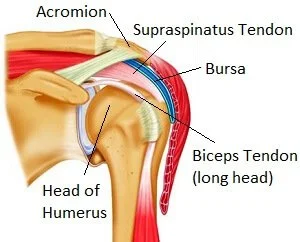 what is acromion pain 