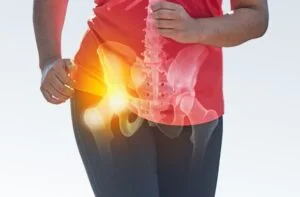 How Long Does Hip Impingement Take To Heal?