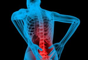 What Does L4 L5 Pain Define?