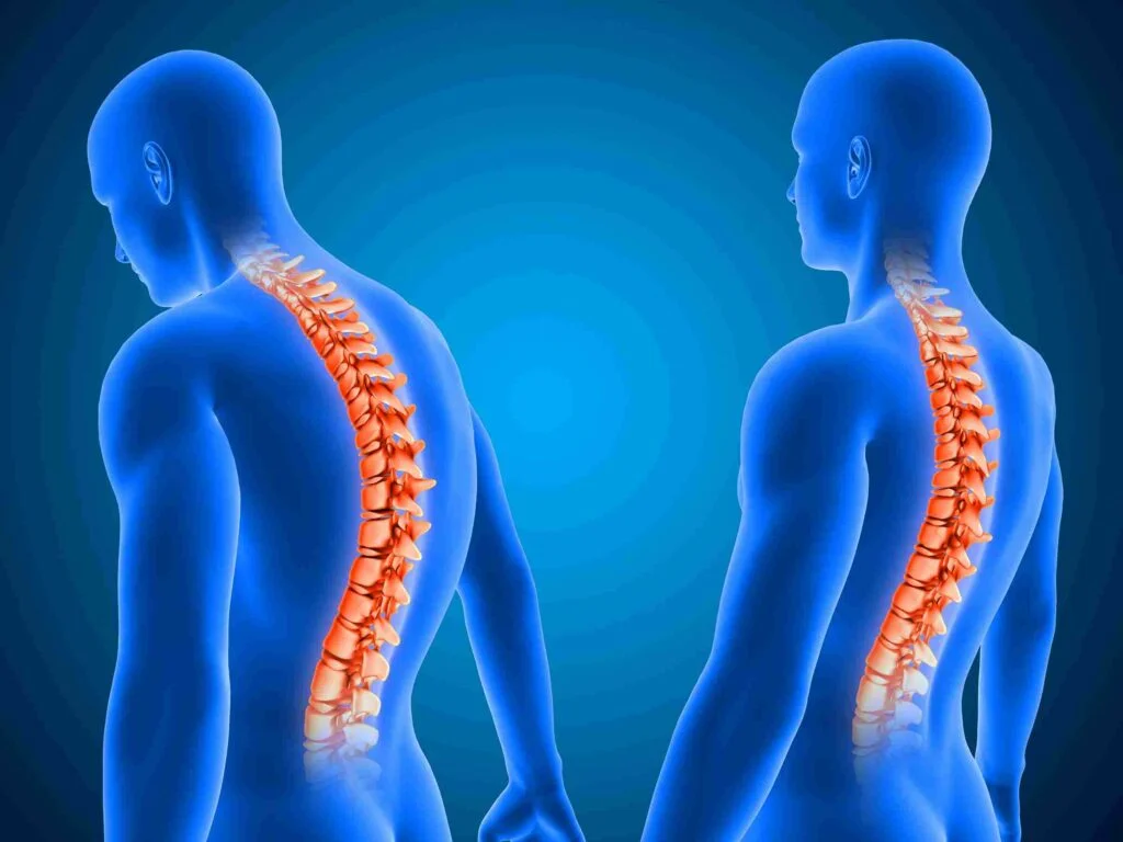 Unwind Your Backbone: Effective Ways to Decompress Your Spine