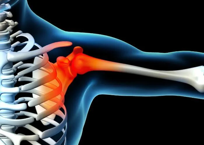 A Comprehensive Guide to Managing Dislocated Shoulder Pain