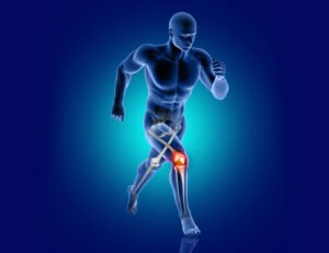 Common Causes of Knee Pain from Working Out