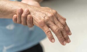 Exploring Guillain Barré Syndrome