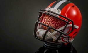 Precautions And Prevention Of Concussions physiotherapy