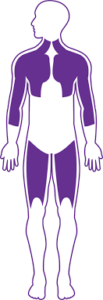 Role of a Physical Therapist
