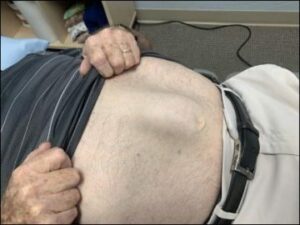 Surgical Therapies