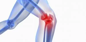 Symptoms and Diagnosis