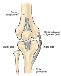 The MCL Physical Therapy Process