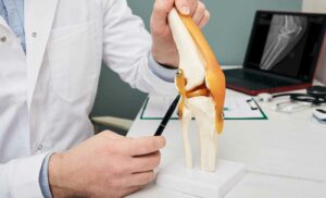 Understanding MCL Injuries
