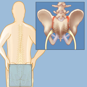Understanding the SI Joint