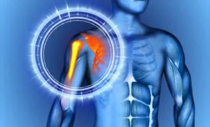 Understanding the Source Of Shoulder Scapula Pain