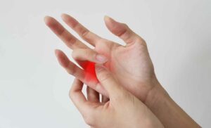 What Is Trigger Finger?