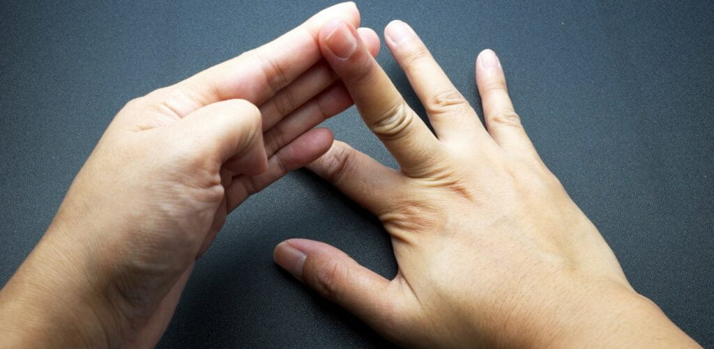 Physical Therapy for Trigger Finger
