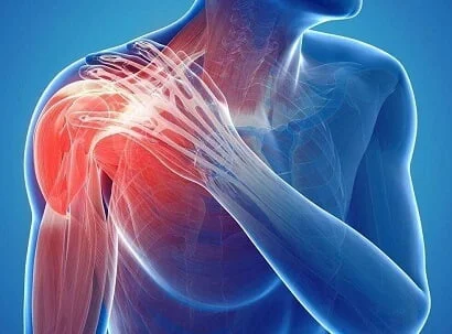 Acromion Pain: Signs, Causes and Treatment Options