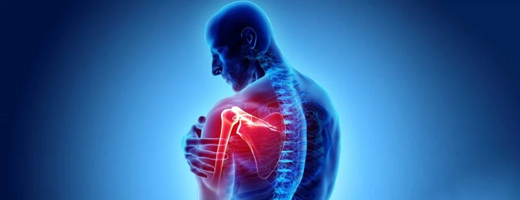 Rheumatoid Arthritis in Shoulder