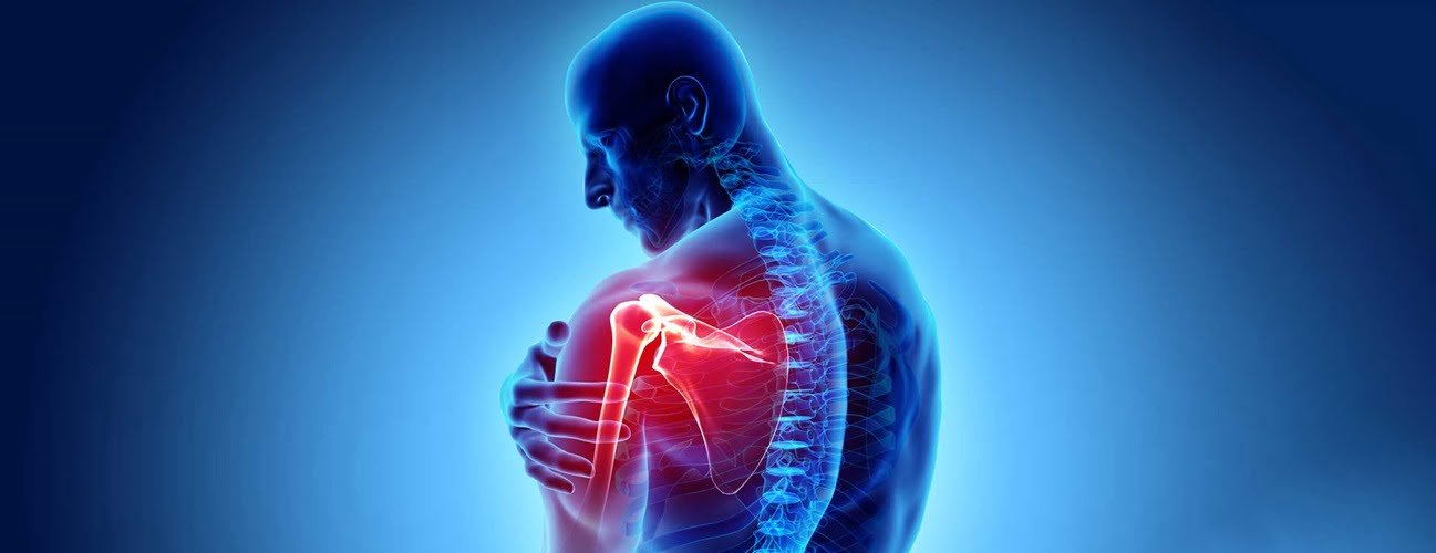Rheumatoid Arthritis in Shoulder